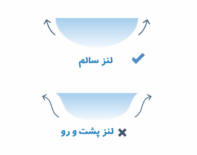 تشخیص پشت و رو بودن لنز تماسی