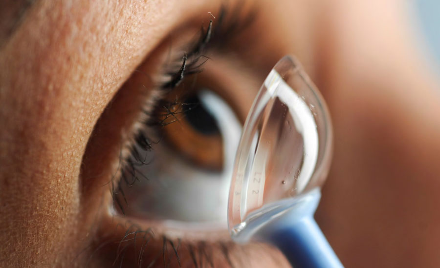 روشهای نگهداری لنزهای اسکلرال