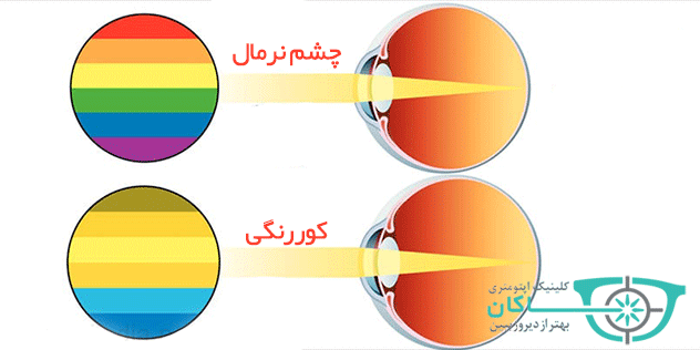 علائم کوررنگی