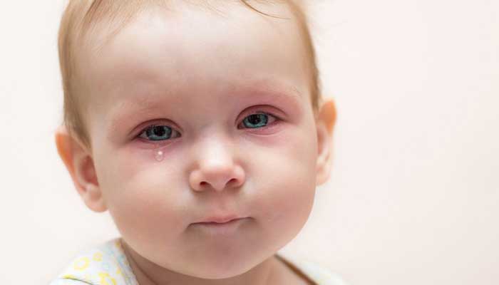علل و درمان ترشحات چشمی در کودکان