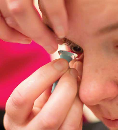 لنزهای اسکلرال معجزه درمان سندرم خشکی چشم