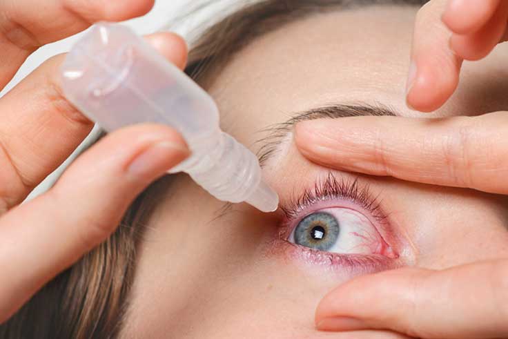مراقبت های بعد از جراحی لیزیک  چشم