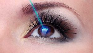 تفاوت جراحی چشم فمتولیزیک و فمتو اسمایل چیست؟